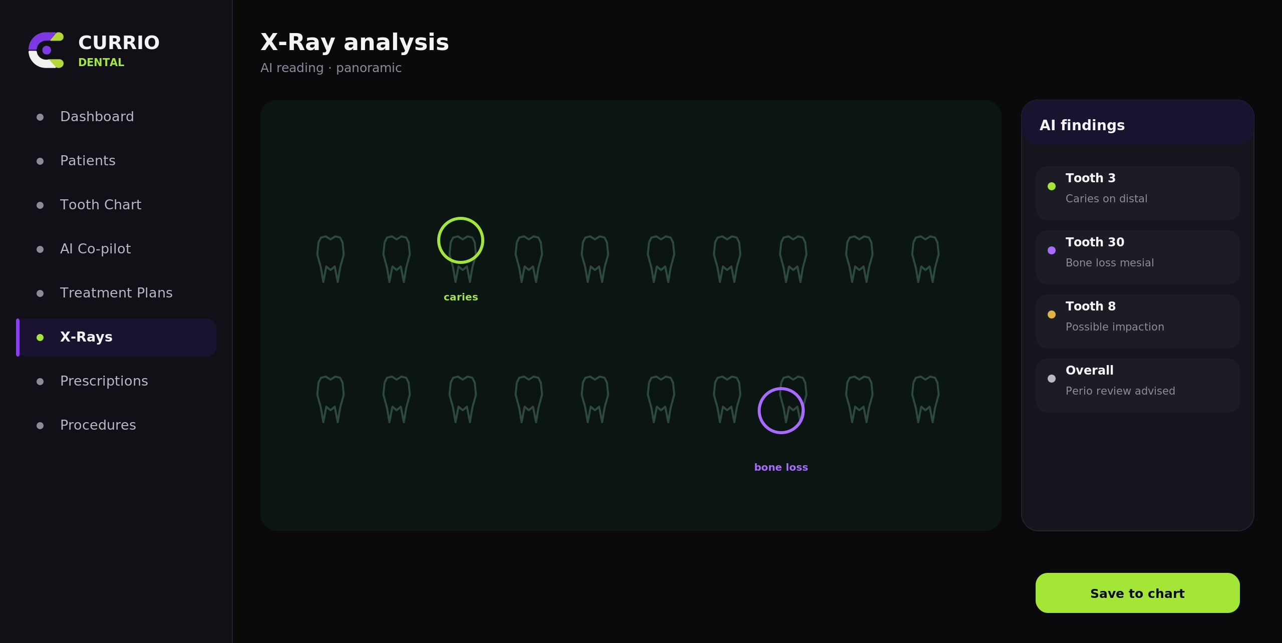 AI X-ray analysis